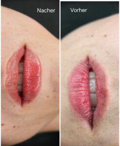 Screenshot_20250816_194448_FotoCollage Maker